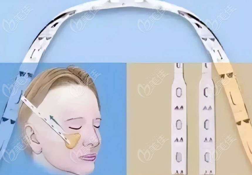 北京华韩做微拉美3.0技术优势 北京华韩做微拉美3.0技术优势