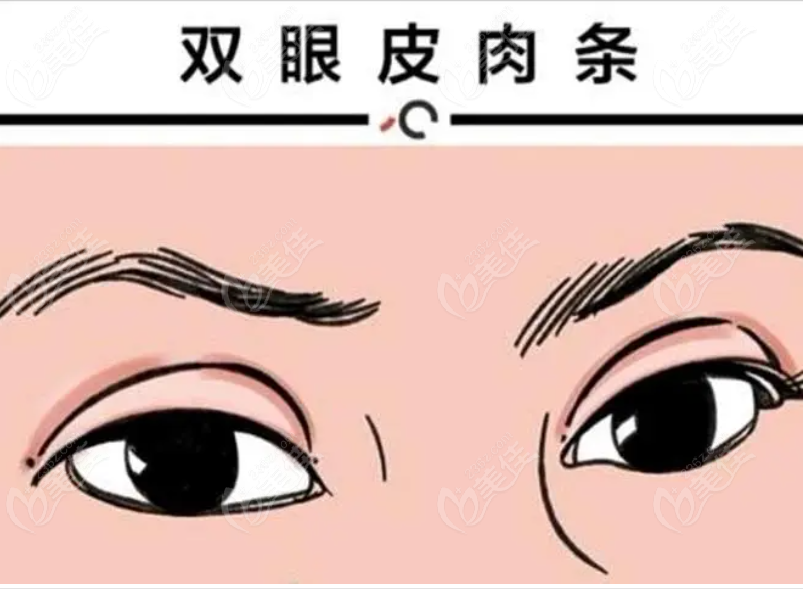 <!--<i data=20240703-sp></i>-->美莱吴海龙医生眼修复技术怎么样 <!--<i data=20240703-sp></i>-->美莱吴海龙医生眼修复技术怎么样