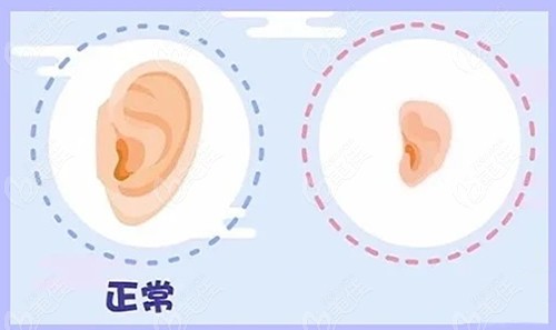 哈尔滨耳畸形矫正医院排名前三家www.236z.com