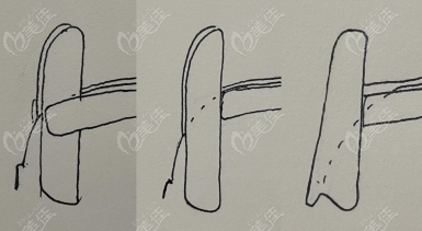 <!--<i data=20240703-sp></i>-->做肋骨鼻好 <!--<i data=20240703-sp></i>-->做肋骨鼻好