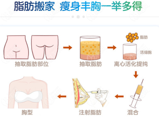 南京华美裴旭芳脂肪隆胸技术好 南京华美裴旭芳脂肪隆胸技术好
