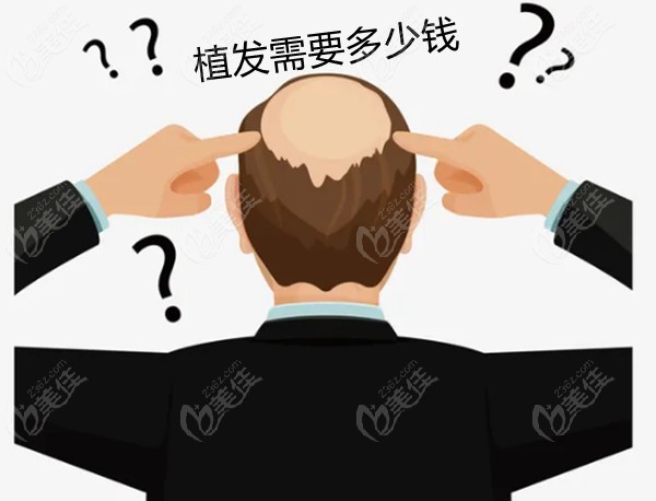 深圳南山区植发价格表