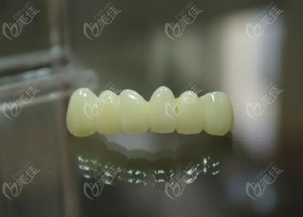 长春牙齿贴面多少钱www.236z.com