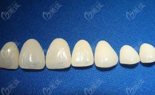 长春全瓷牙贴面多少钱一颗