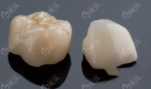 <!--<i data=20240703-sp></i>-->口腔镶牙价格表 <!--<i data=20240703-sp></i>-->口腔镶牙价格表