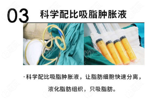 宋新吸脂做得怎么样 宋新吸脂做得怎么样