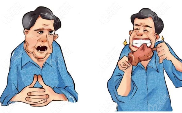 在<!--<i data=20240703-sp></i>-->做全口种植牙前后漫画对比图