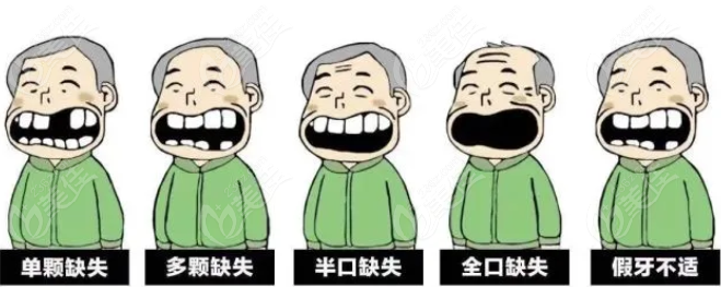 广东种植牙集采活动