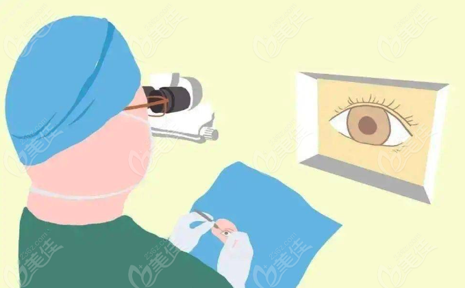 近视眼矫正手术可以报销吗