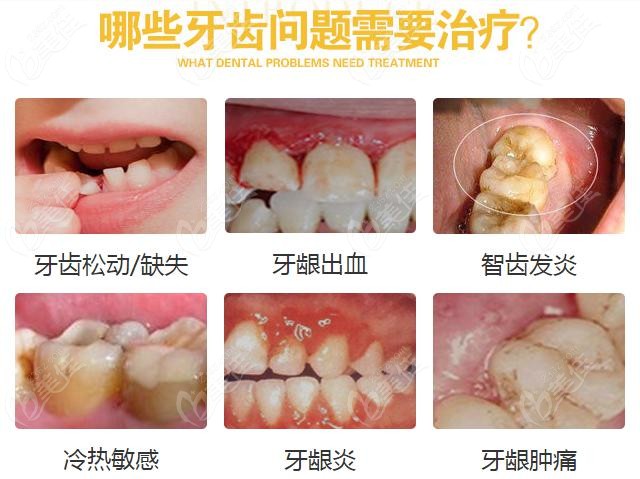 天水华济口腔诊所牙齿治疗236z.com