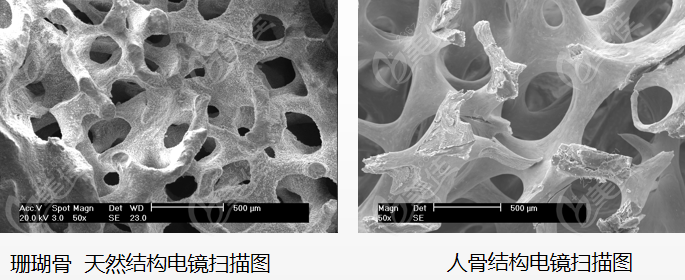 珊瑚骨隆鼻材料和人骨机构相似