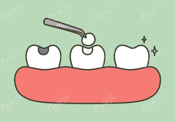 树脂补牙材料对人体有害吗