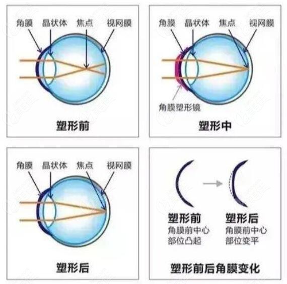 ok镜使用前后对比