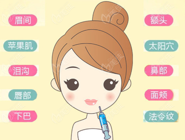 韩国玻尿酸排名前三品牌推荐 236z.com