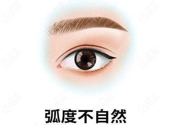 上海华美修复双眼皮怎么样www.236z.com