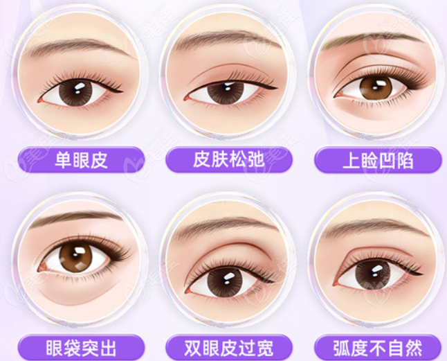 四川友谊医院做双眼皮哪个医生好