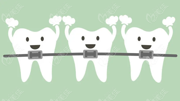 杭州西湖区儿童牙齿早期干预矫正收费美佳网