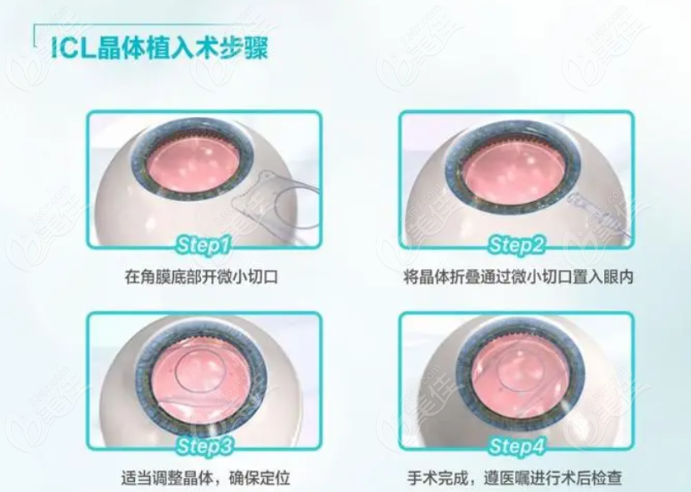 <!--<i data=20240703-sp></li>
<li><i data=20240703-sp></i>-->和平眼科医院翟爱琴医生出诊时间