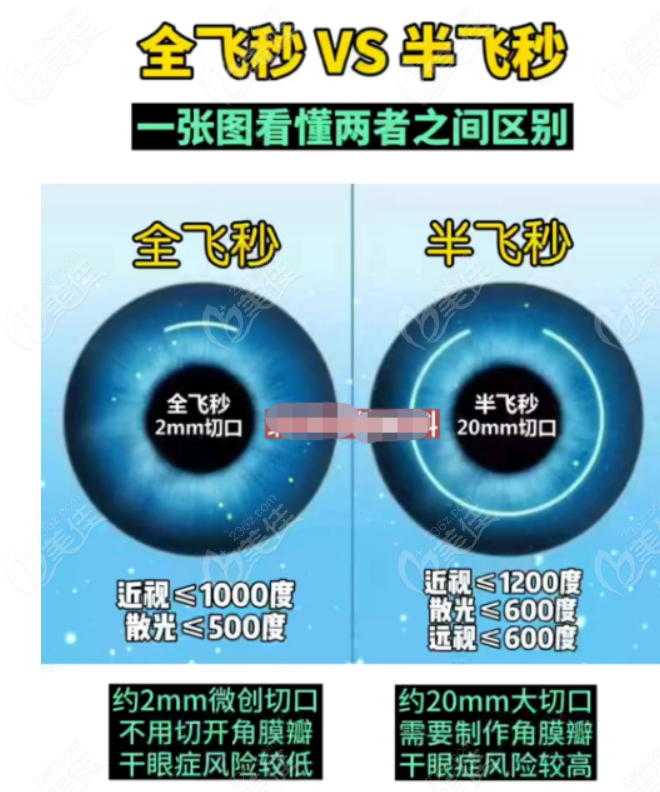 半飞秒和全飞秒近视手术哪个好 半飞秒和全飞秒近视手术哪个好