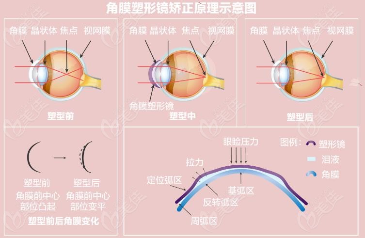 什么是OK镜？