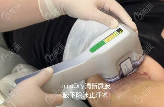 miradry清新微波去除狐臭m.236z.com