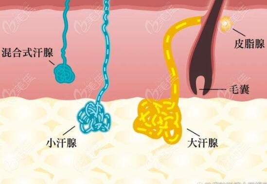 做腋下狐臭手术费用一般要多少钱