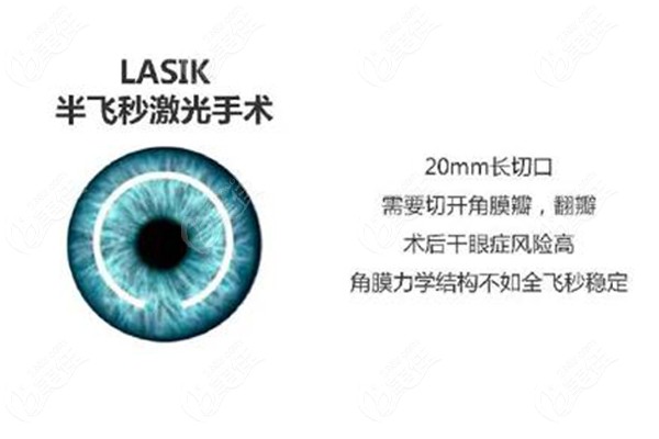 半飞秒激光手术