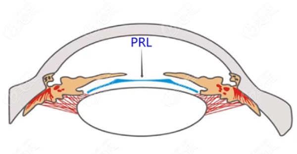 prl晶体