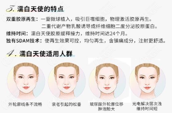 濡白天使的优势