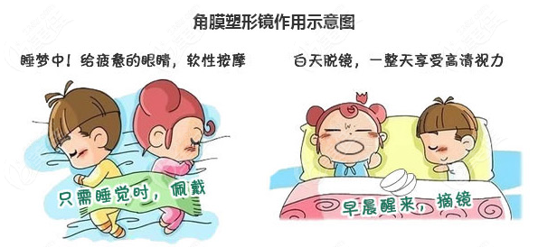 <!--<i data=20240703-sp></i>-->和平眼科儿童角膜塑形镜改善近视236z.com