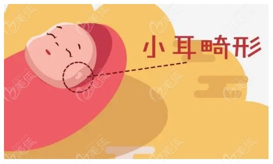 <!--<i data=20240703-sp></i>-->耳再造價格
