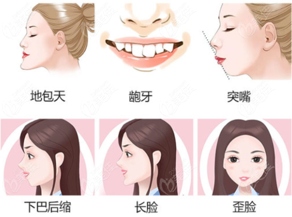 罗恩和叶斌医生正颌技术哪个好 美佳网