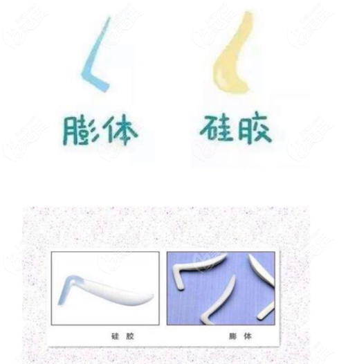 假体垫眉弓怎么样