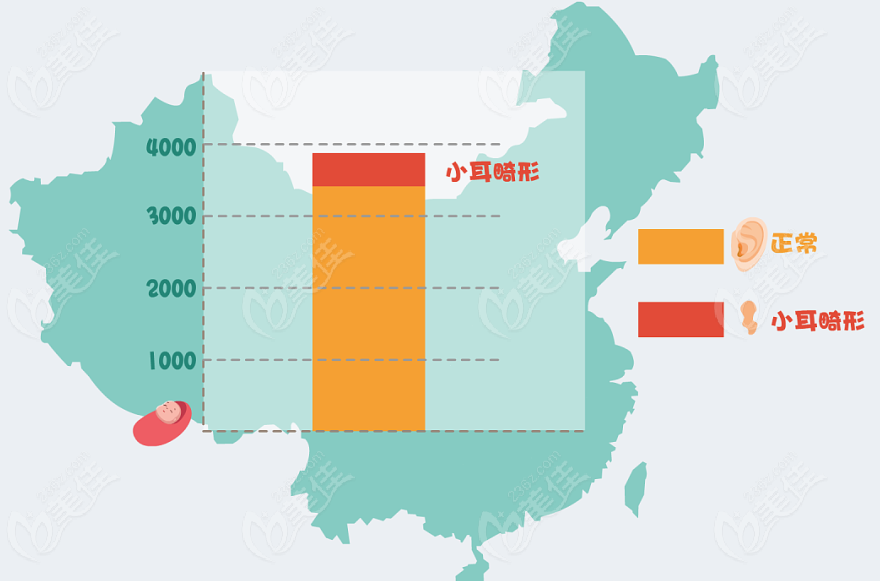 畸形耳朵整形医生可做小耳再造