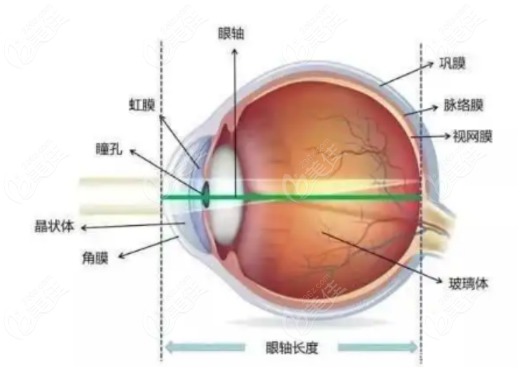 普瑞眼科做近视眼手术