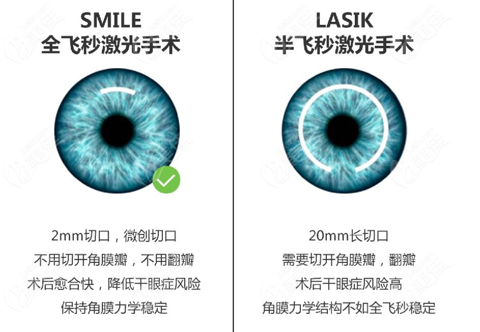 北京華德眼科醫(yī)院近視眼手術(shù)價格表m.236z.com