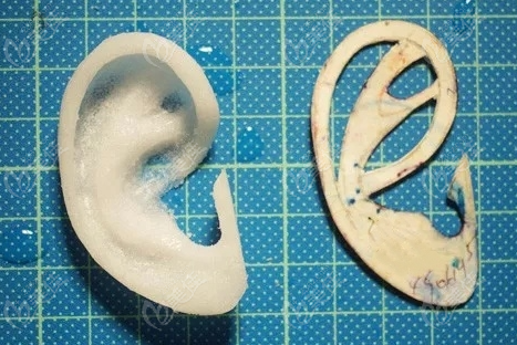 耳再造手术过程 美佳网