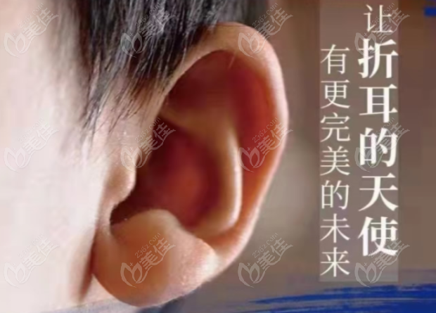 現(xiàn)在耳再造技術(shù)成熟嗎