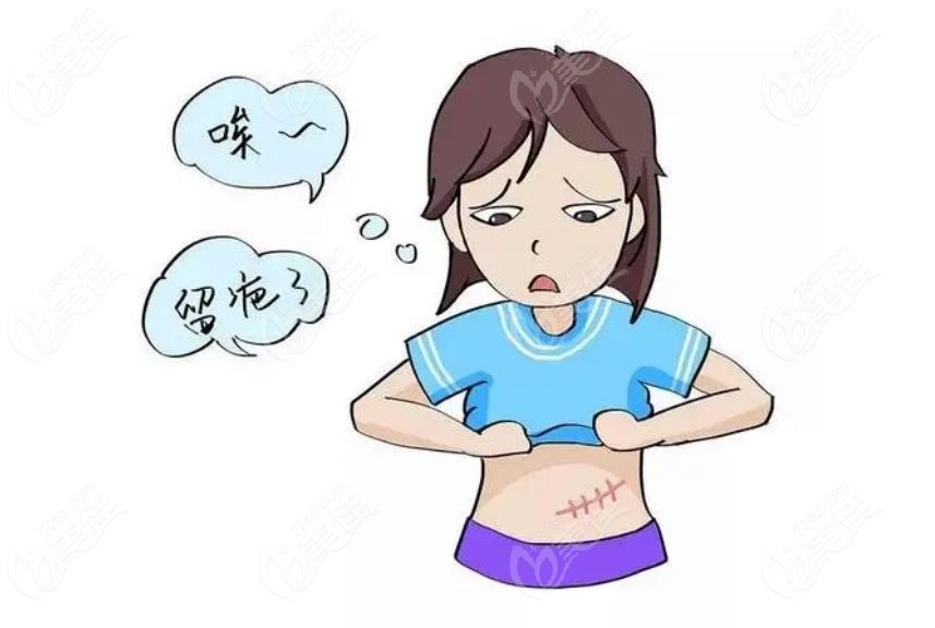 浅放srt-100疤痕放疗是骗局吗?