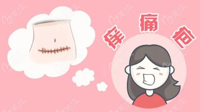 浅放srt-100治疗疤痕疙瘩真的有用
