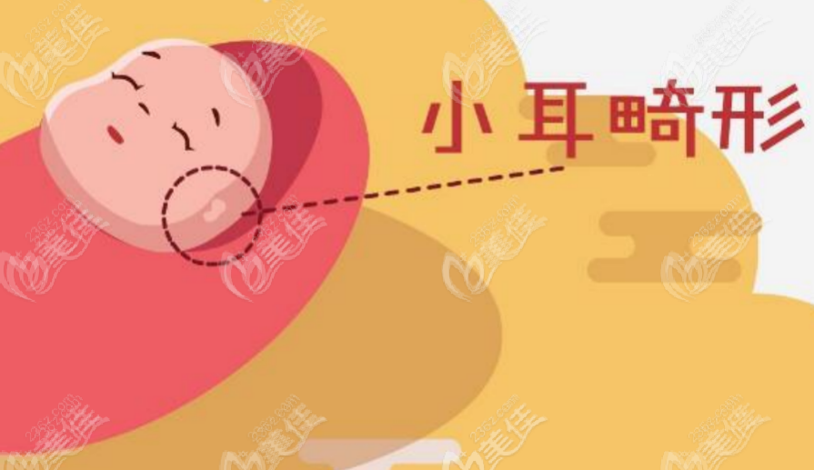 廣州高尚小耳畸形