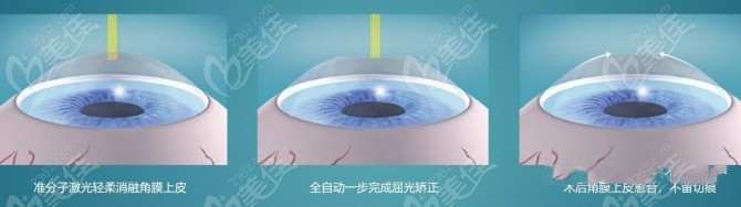 西安近视全飞秒手术价格一览表236z.com
