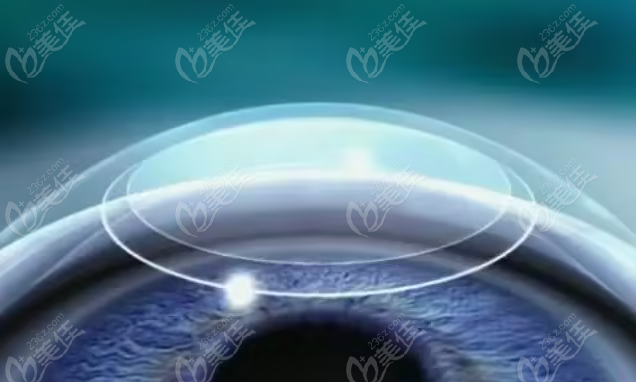 南昌全飛秒手術(shù)價格一覽表m.xqnp.cn