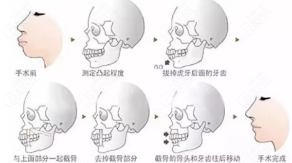 成都正颌手术医生排名推荐