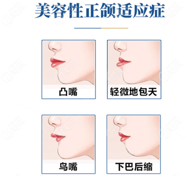成都正颌手术医生谁更强