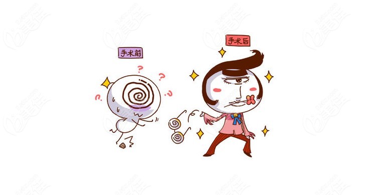 近視手術(shù)