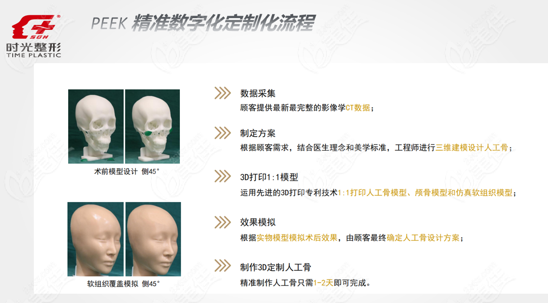 何晋龙医生3d打印peek人工骨修复过程和步骤
