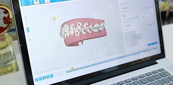 天水兔博士口腔牙齿矫正技术236z.com