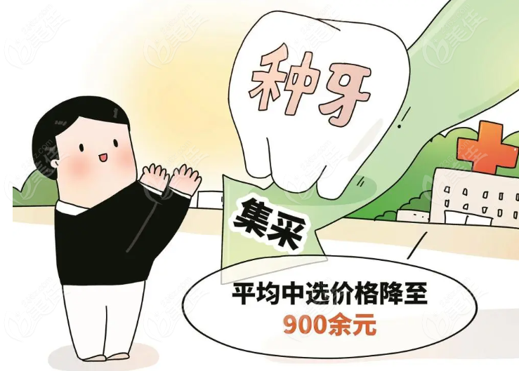种植牙集采后价格