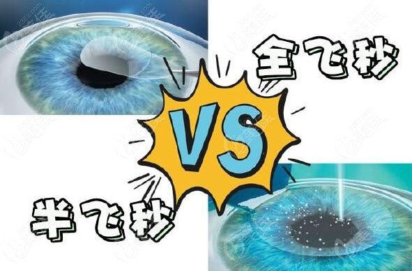 沈陽何氏眼科醫(yī)院近視眼價格表